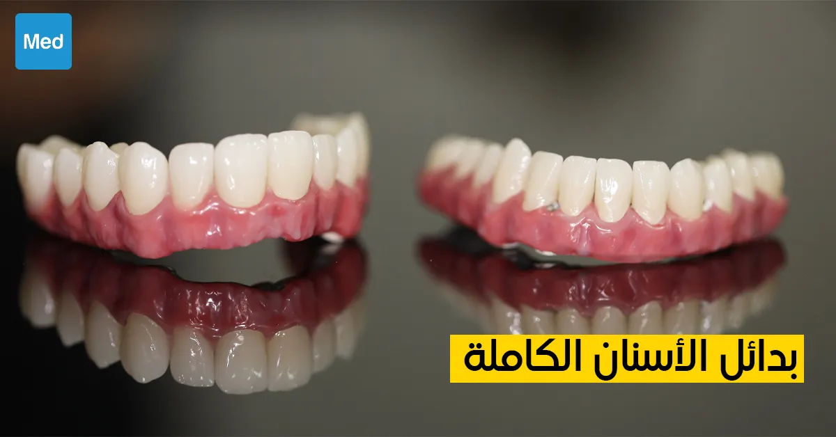 بدائل الأسنان الكاملة